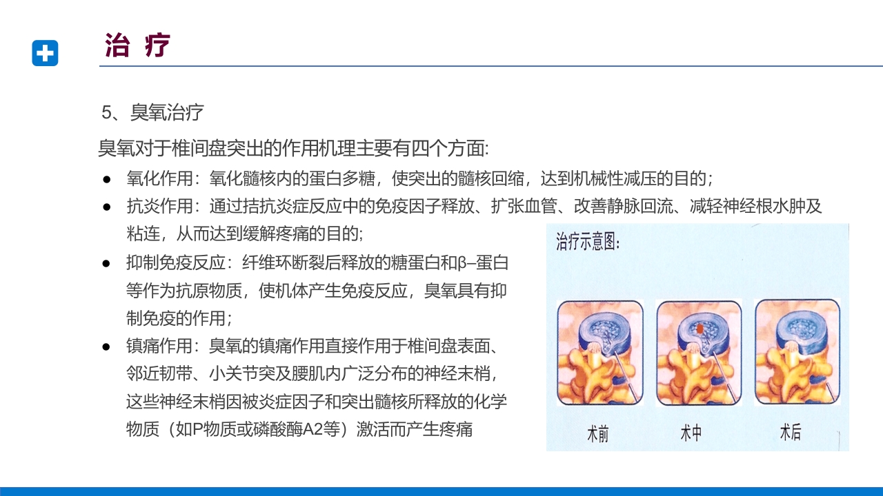 腰椎间盘突出症诊断与治疗PPT课件下载62