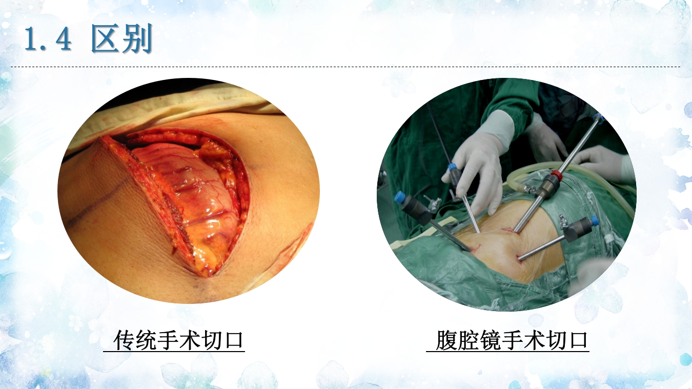 腹腔镜器械清洗与消毒PPT课件17