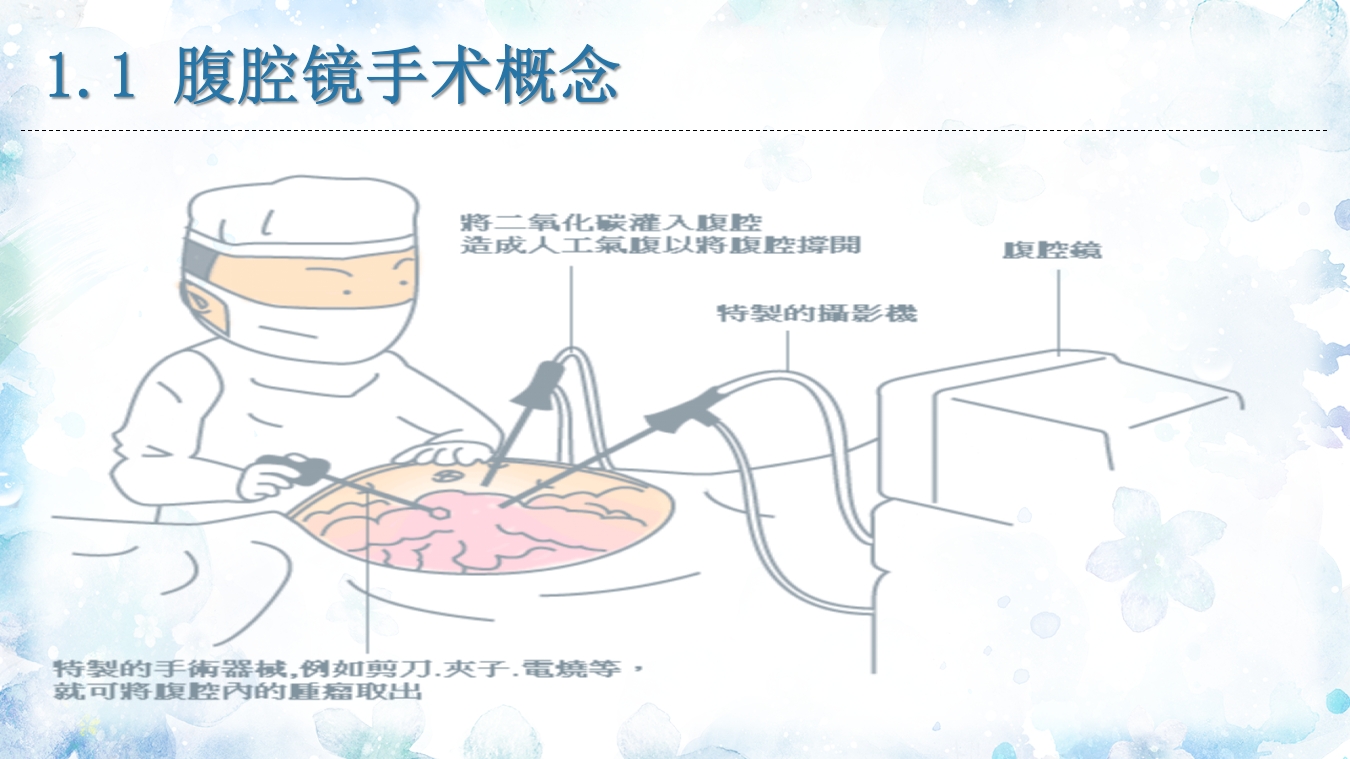 腹腔镜器械清洗与消毒PPT课件7