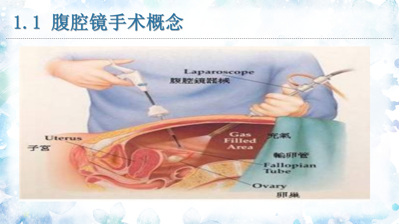 腹腔镜器械清洗与消毒PPT课件8