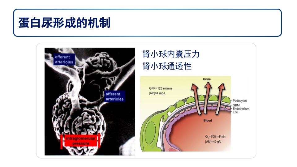 糖尿病肾病PPT课件30