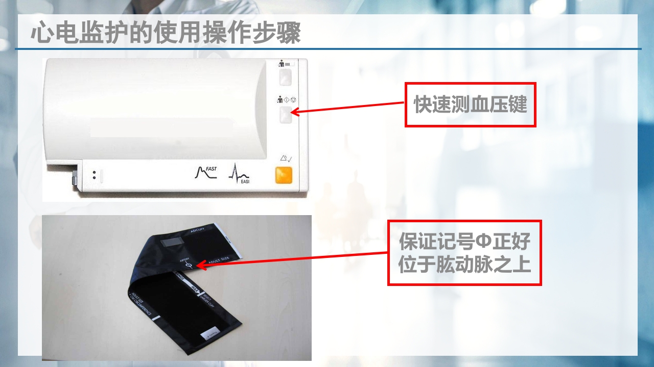 床旁心电监测技术ppt课件11