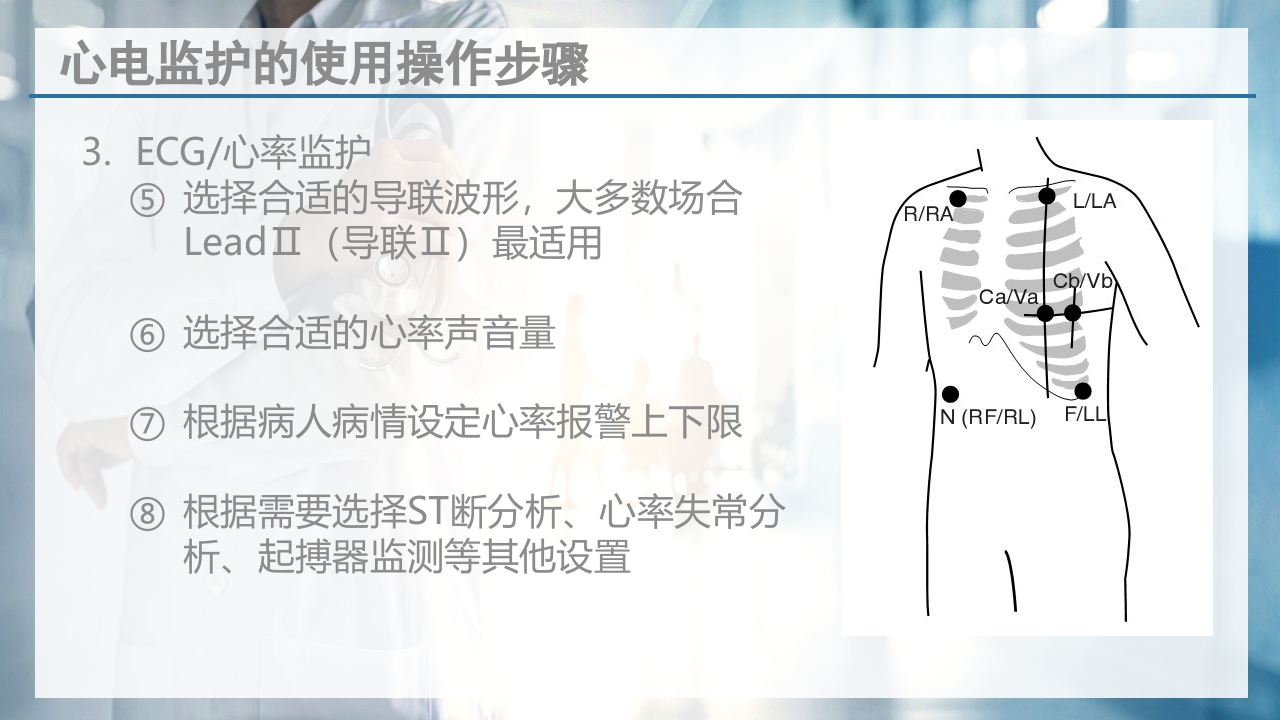 床旁心电监测技术ppt课件8