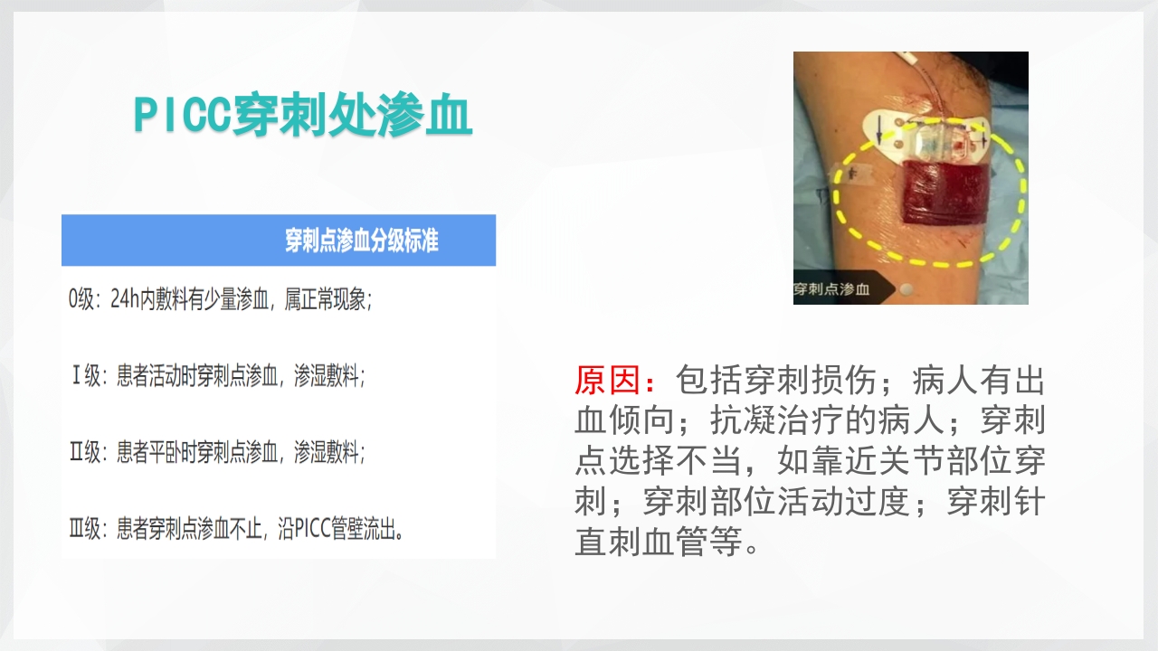 PICC置管后常见并发症的处理PPT课件16
