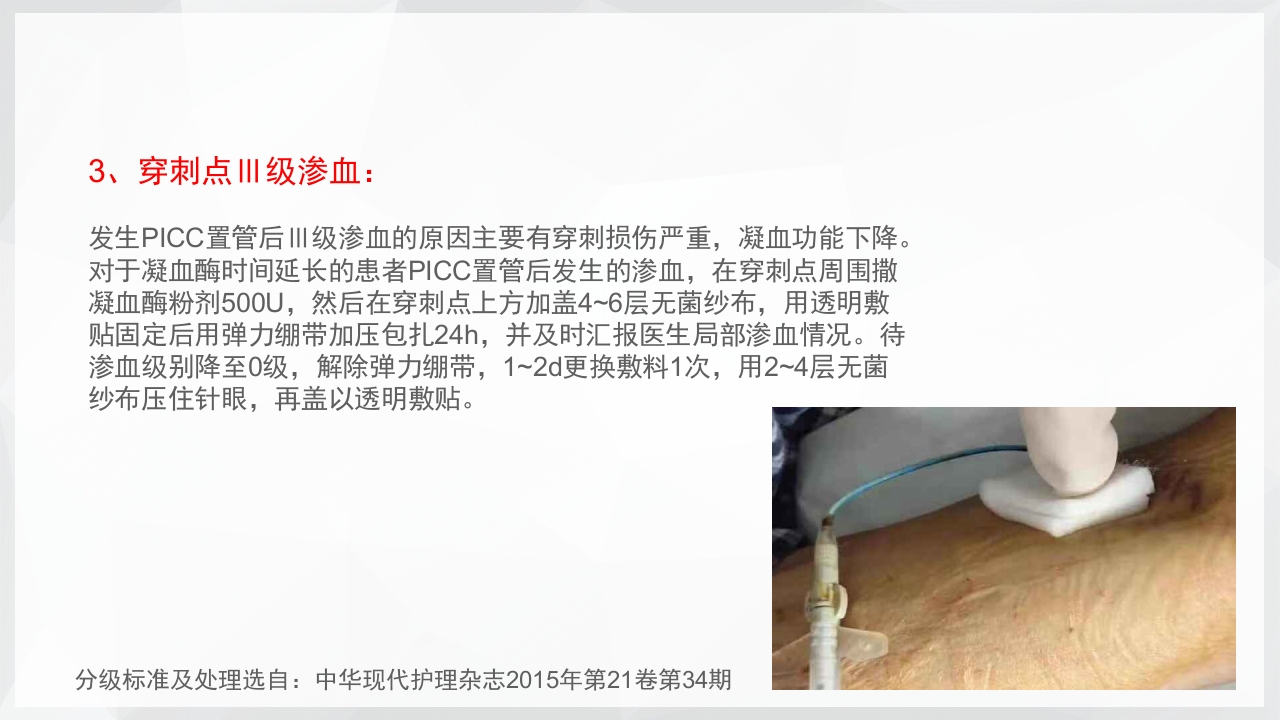 PICC置管后常见并发症的处理PPT课件18