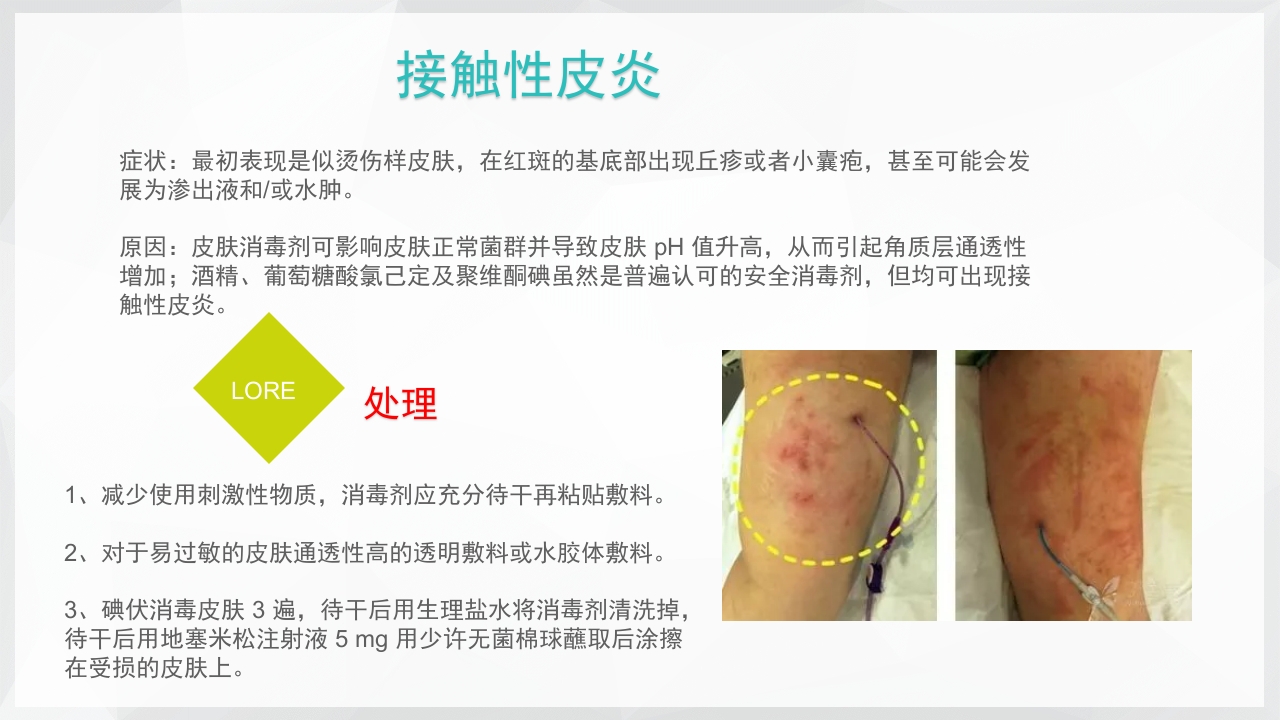 PICC置管后常见并发症的处理PPT课件30