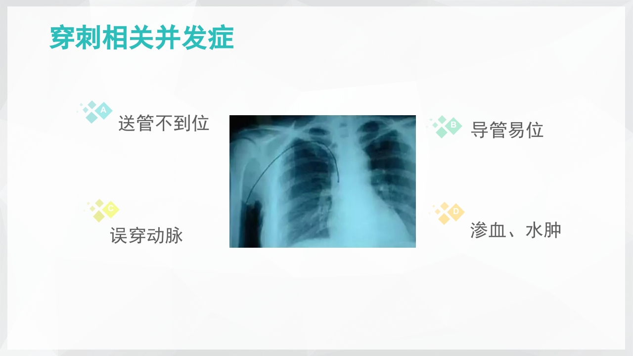 PICC置管后常见并发症的处理PPT课件4