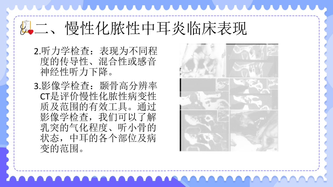 慢性化脓性中耳炎病人的护理PPT课件8