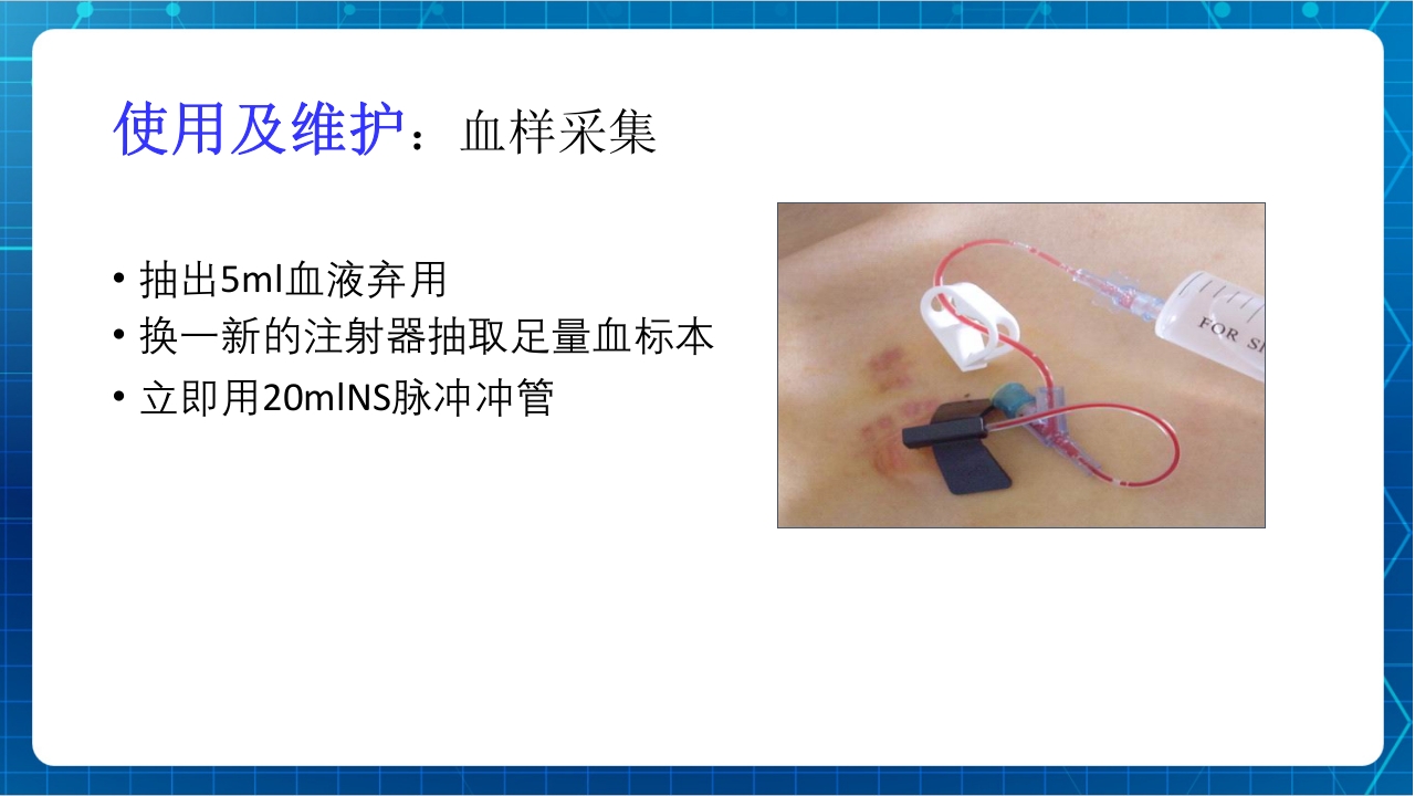 PICC与输液港的使用及维护PPT课件下载25