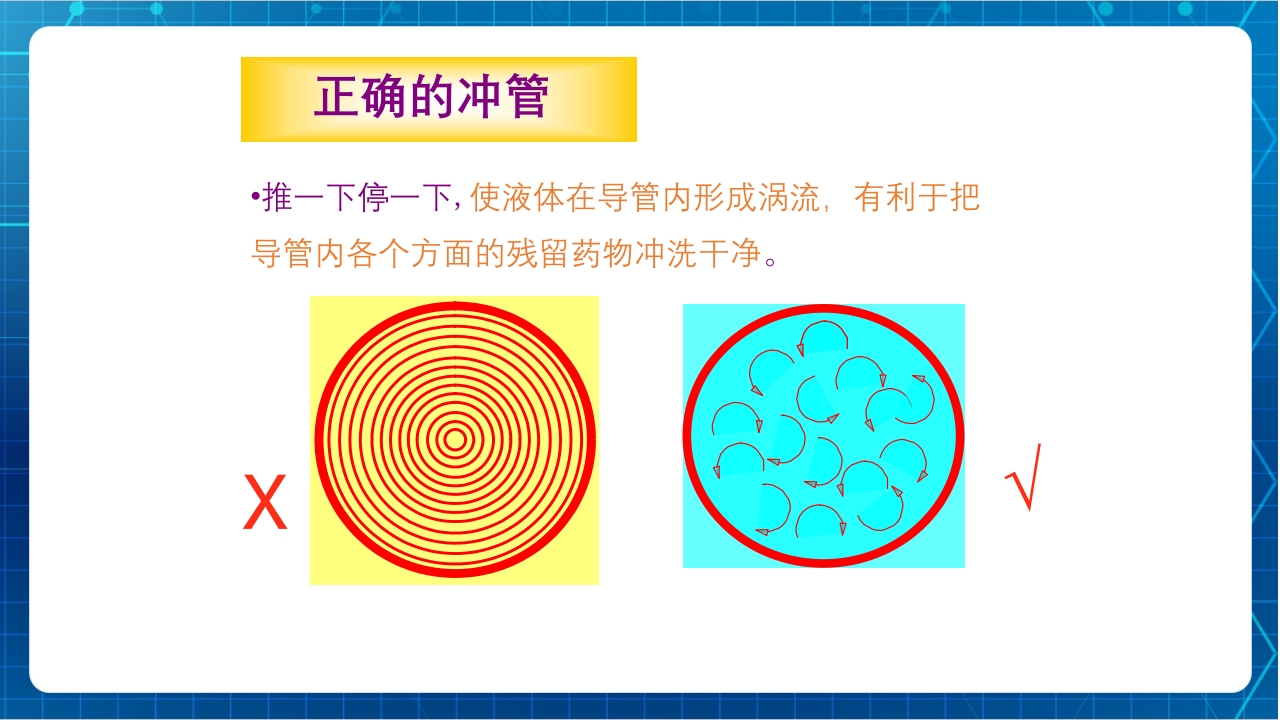 PICC与输液港的使用及维护PPT课件下载7