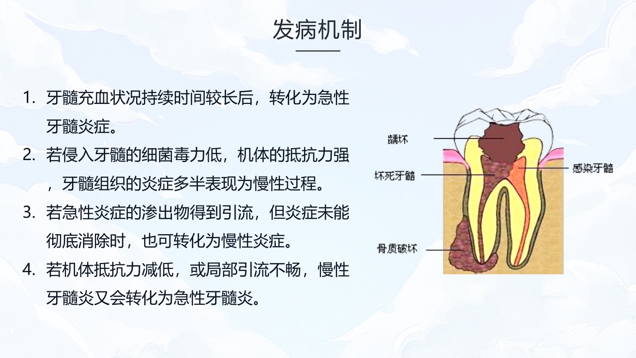 牙髓炎的护理查房PPT课件下载10