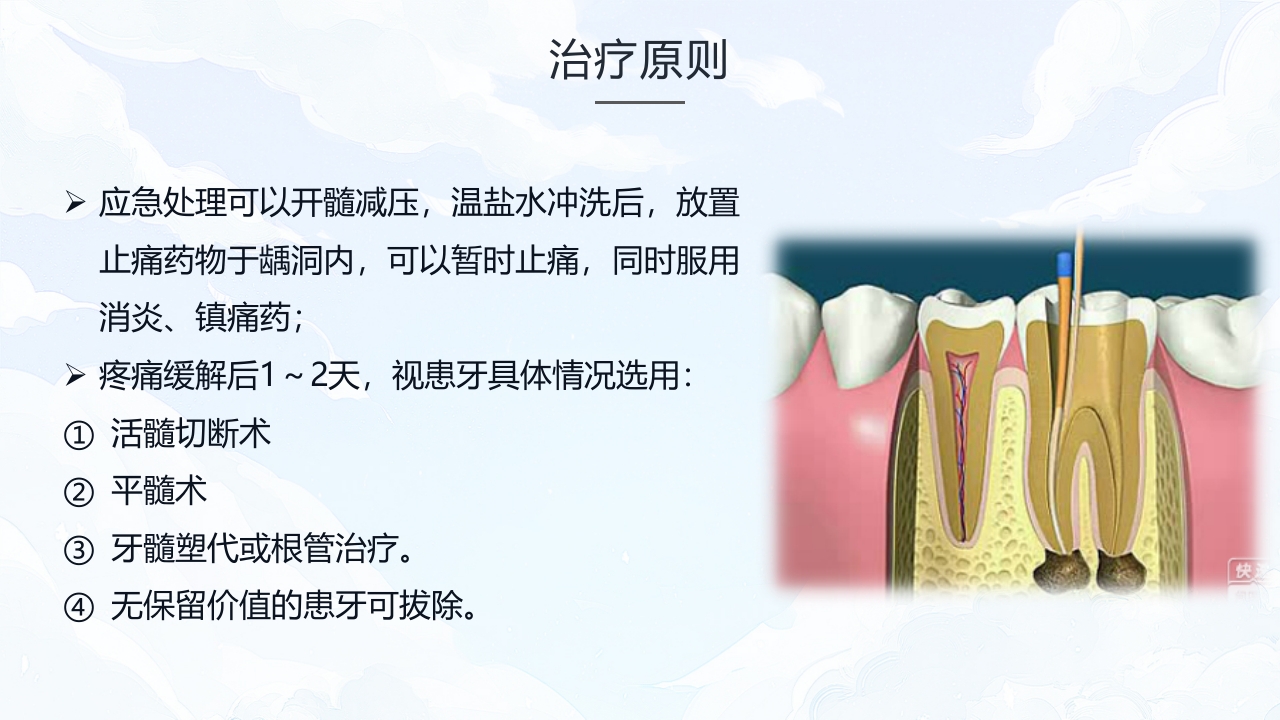 牙髓炎的护理查房PPT课件下载14