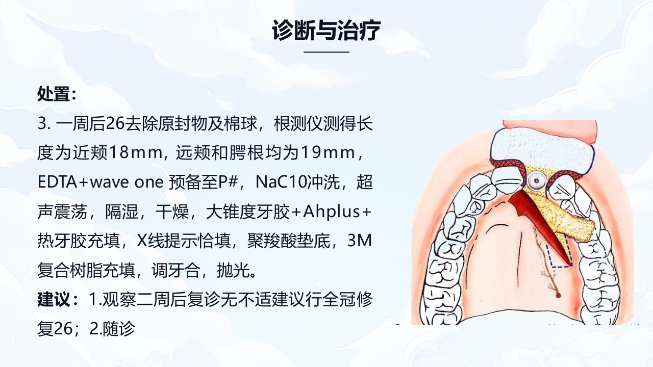 牙髓炎的护理查房PPT课件下载19