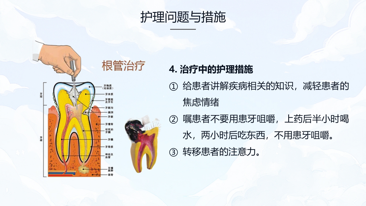 牙髓炎的护理查房PPT课件下载25