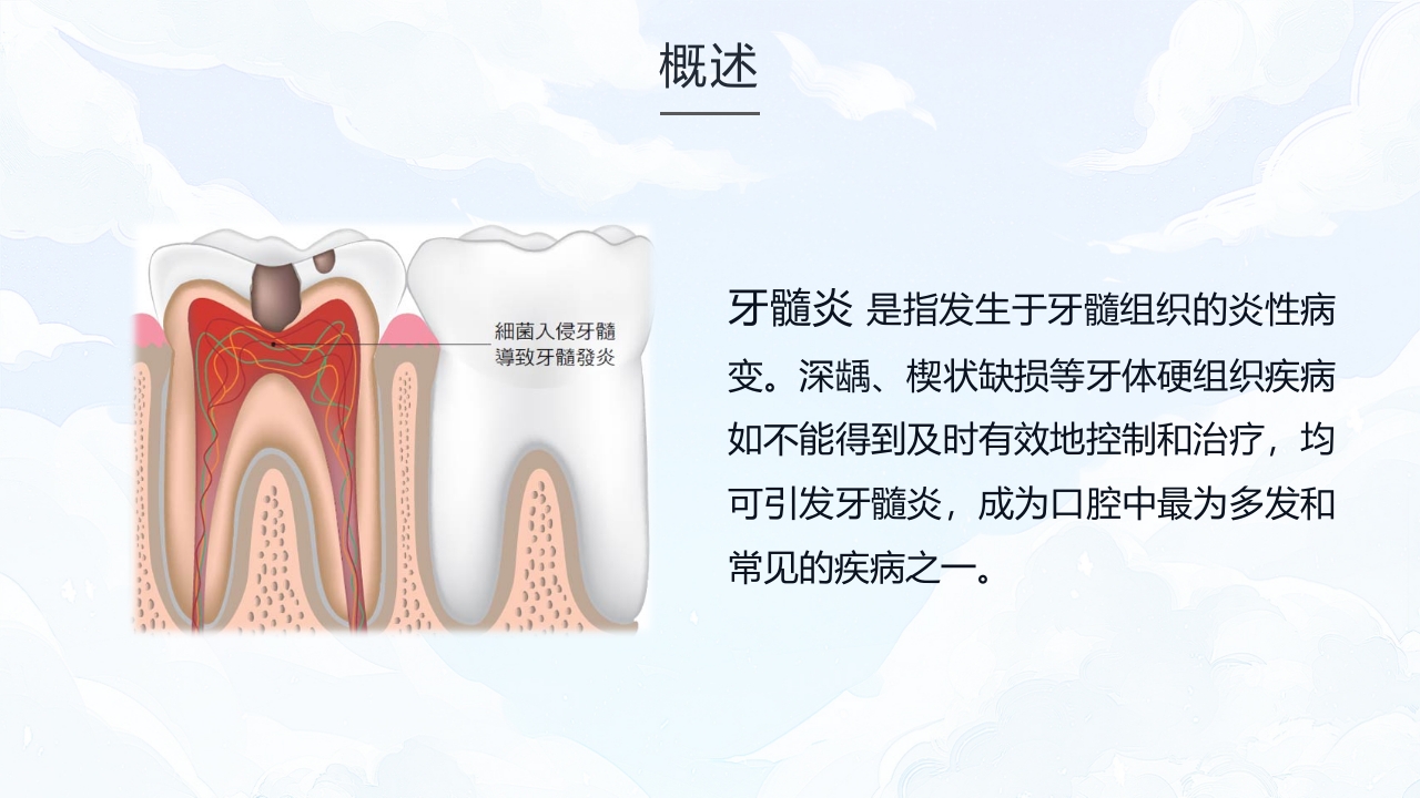 牙髓炎的护理查房PPT课件下载4