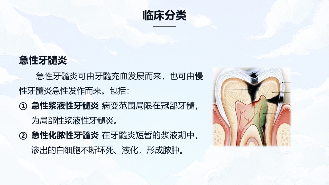 牙髓炎的护理查房PPT课件下载5