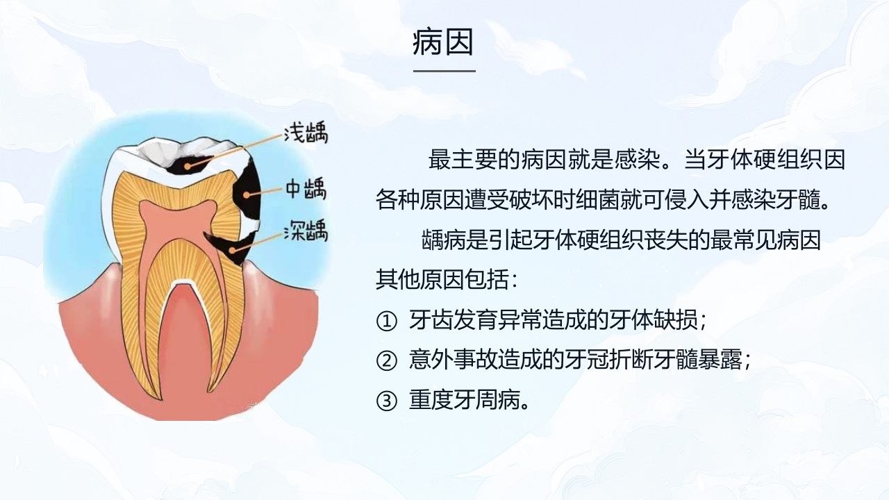 牙髓炎的护理查房PPT课件下载8