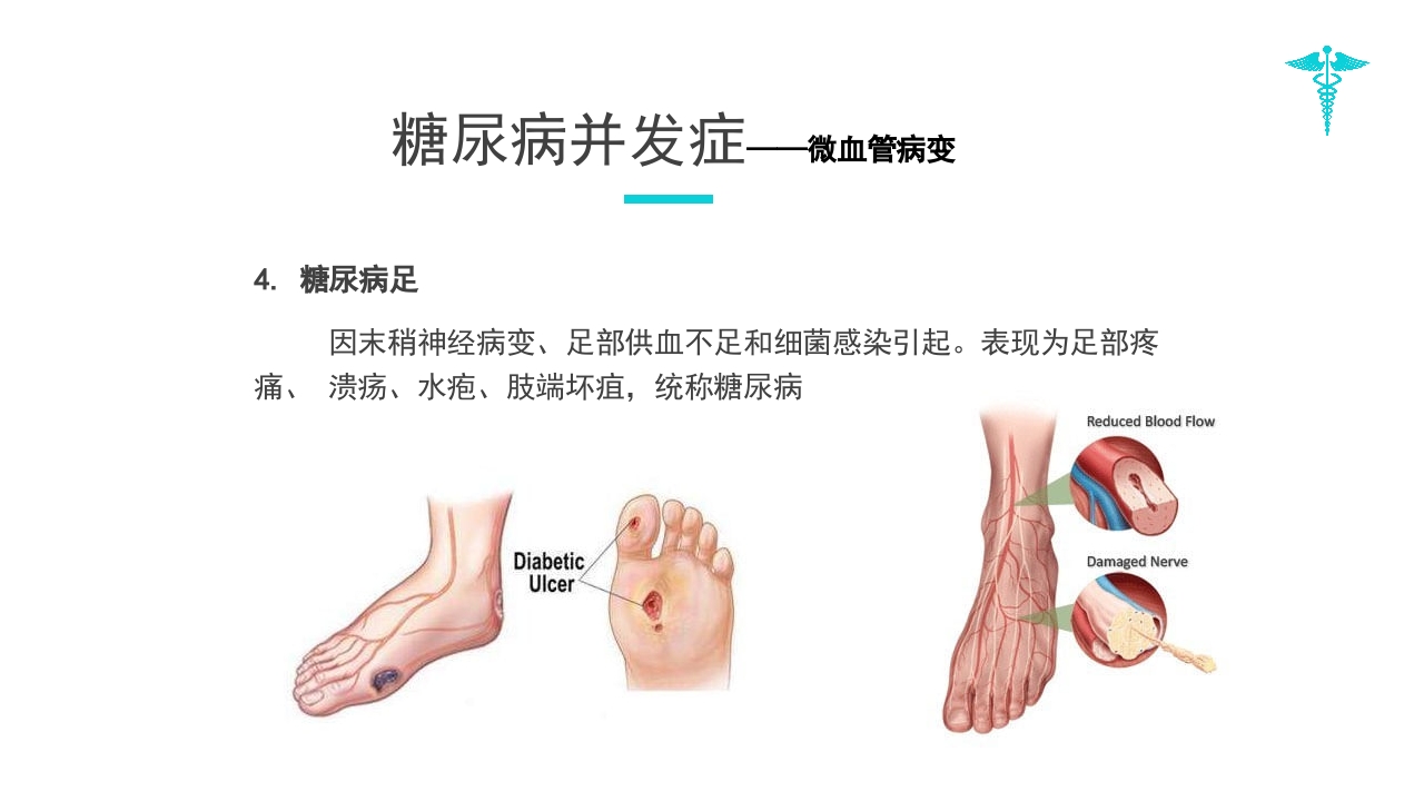 糖尿病教学PPT课件下载21