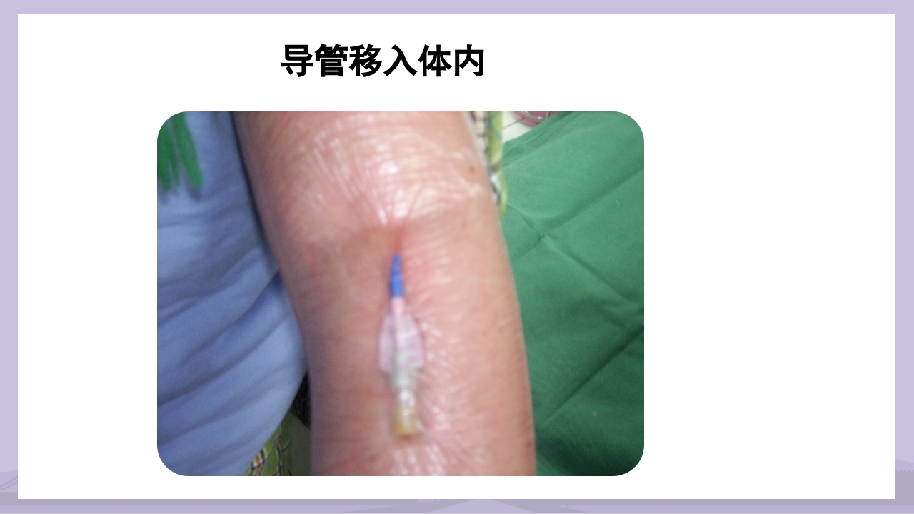PICC导管介绍及维护PPT课件31