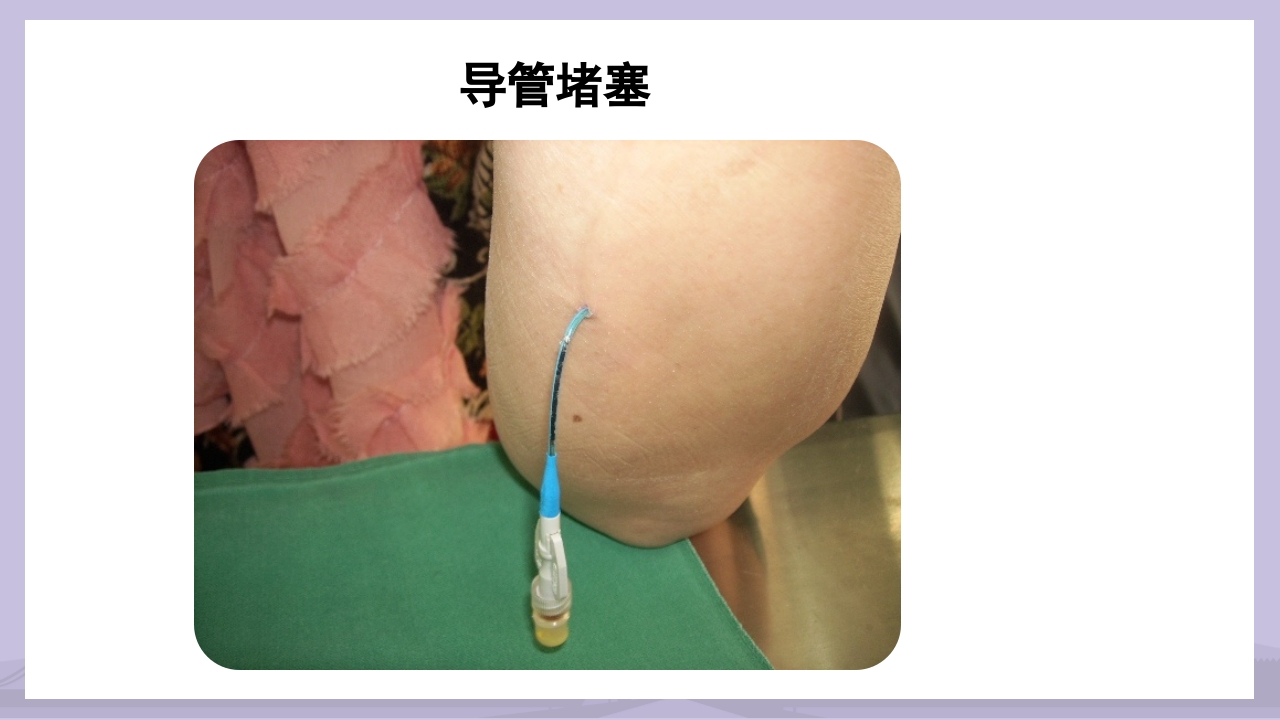 PICC导管介绍及维护PPT课件32