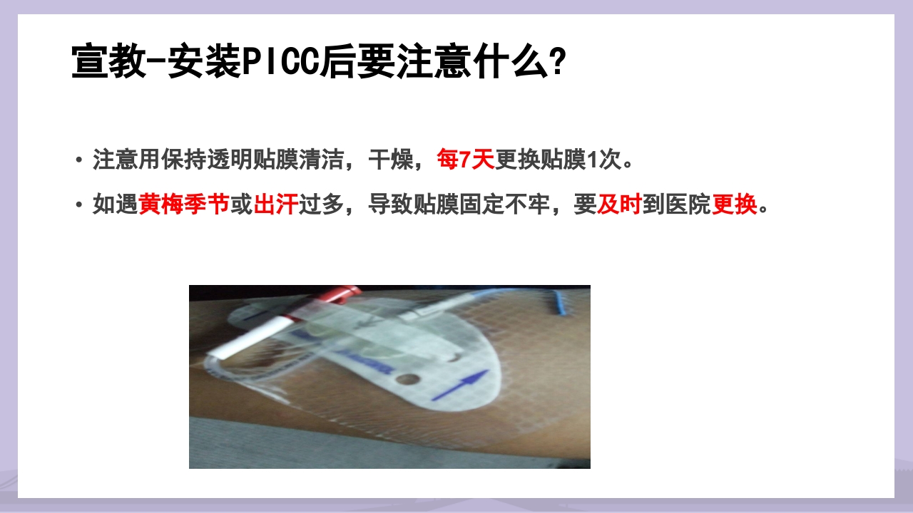 PICC导管介绍及维护PPT课件33