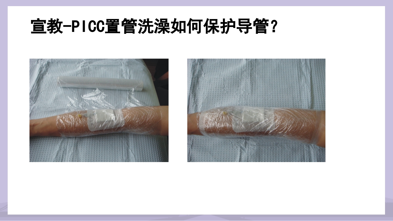 PICC导管介绍及维护PPT课件40