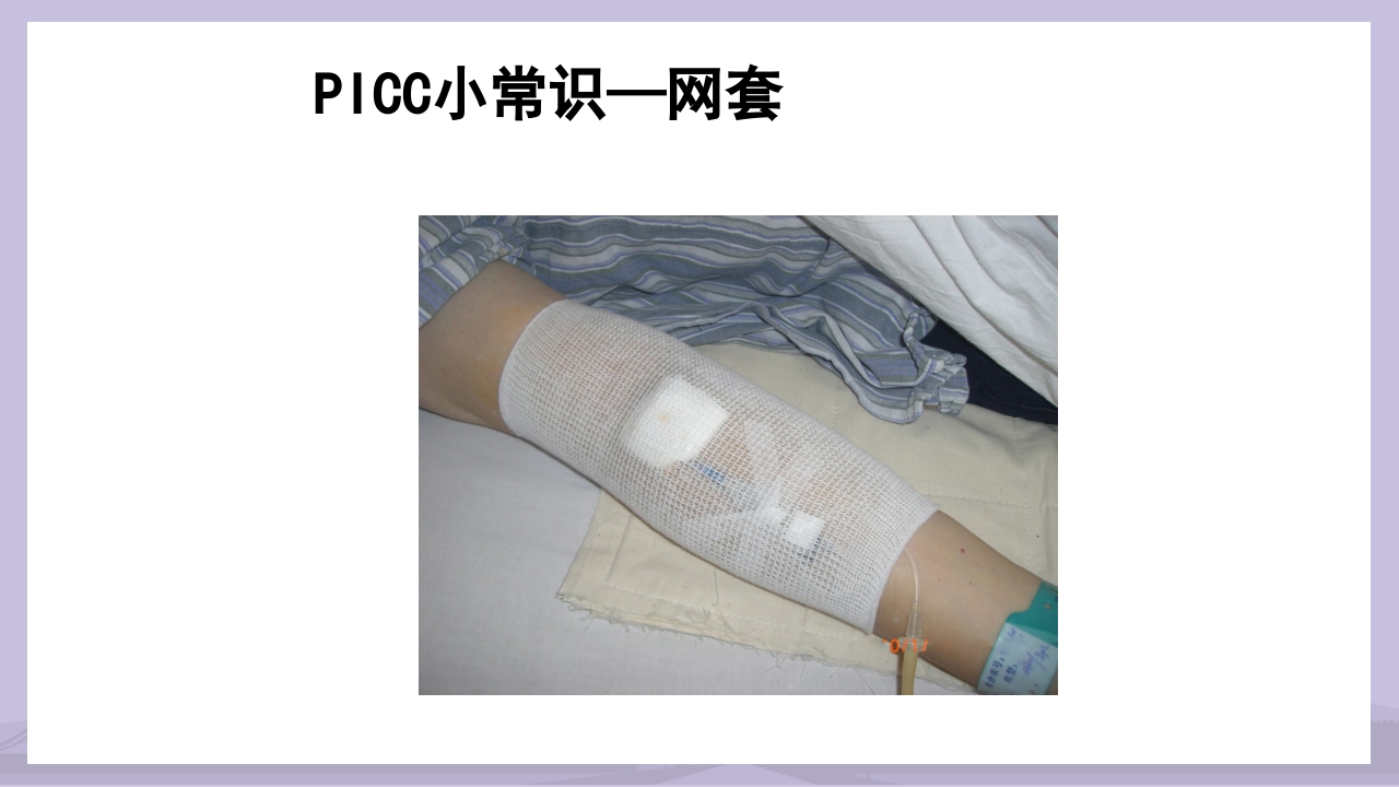 PICC导管介绍及维护PPT课件41