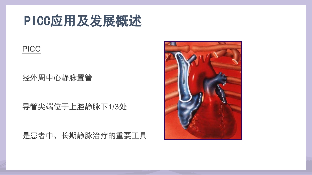 PICC导管介绍及维护PPT课件4