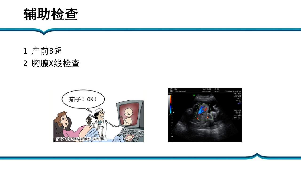 脐膨出患儿的护理PPT课件下载10