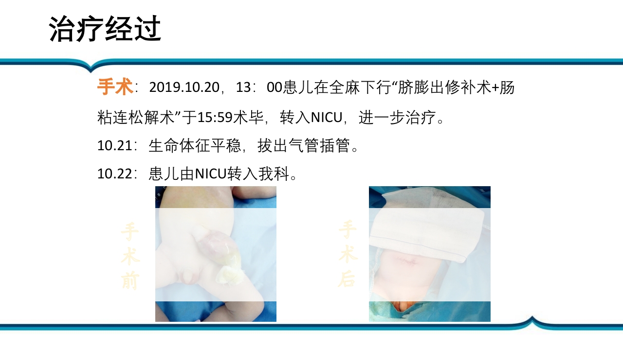 脐膨出患儿的护理PPT课件下载18
