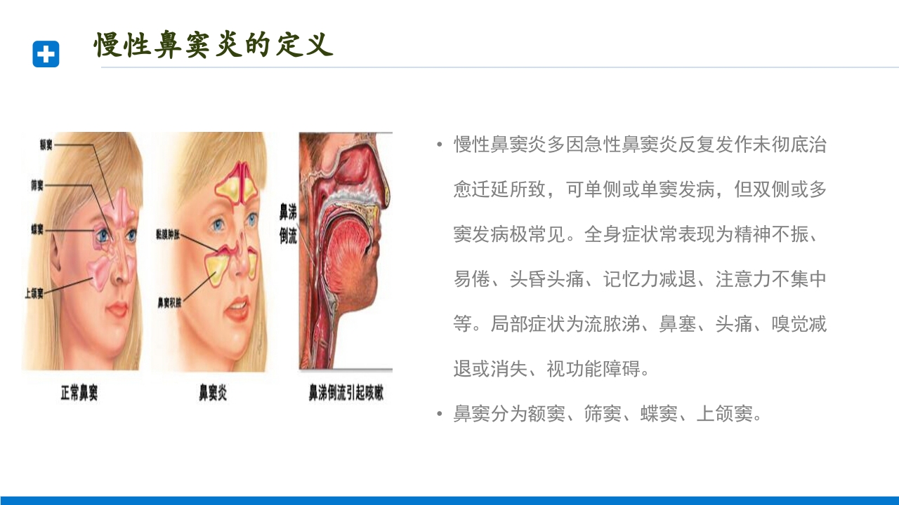 慢性鼻窦炎患者护理查房PPT课件2