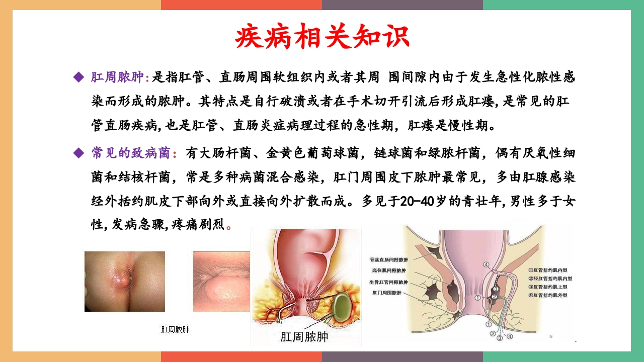 肛周脓肿护理查房PPT课件4