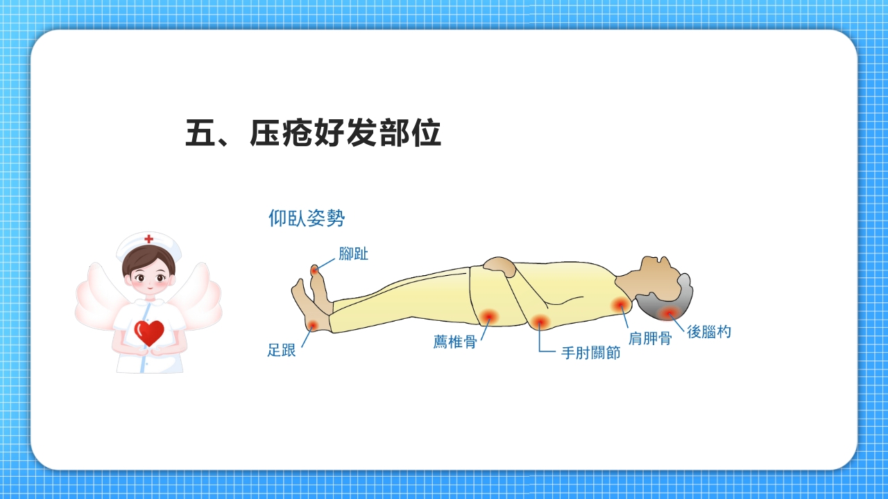 医疗压疮护理查房PPT课件10