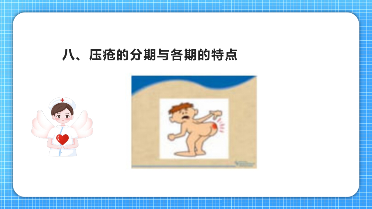 医疗压疮护理查房PPT课件17