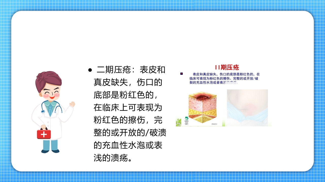 医疗压疮护理查房PPT课件19