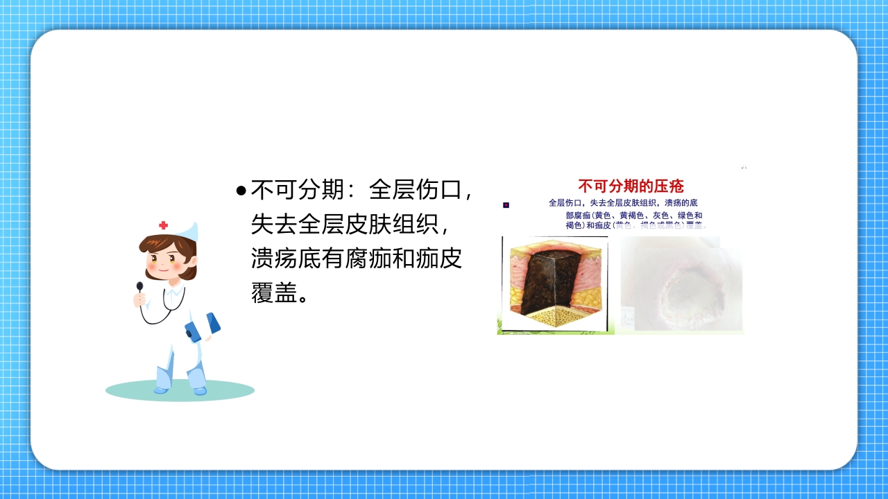 医疗压疮护理查房PPT课件22