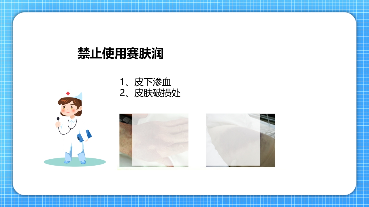 医疗压疮护理查房PPT课件28