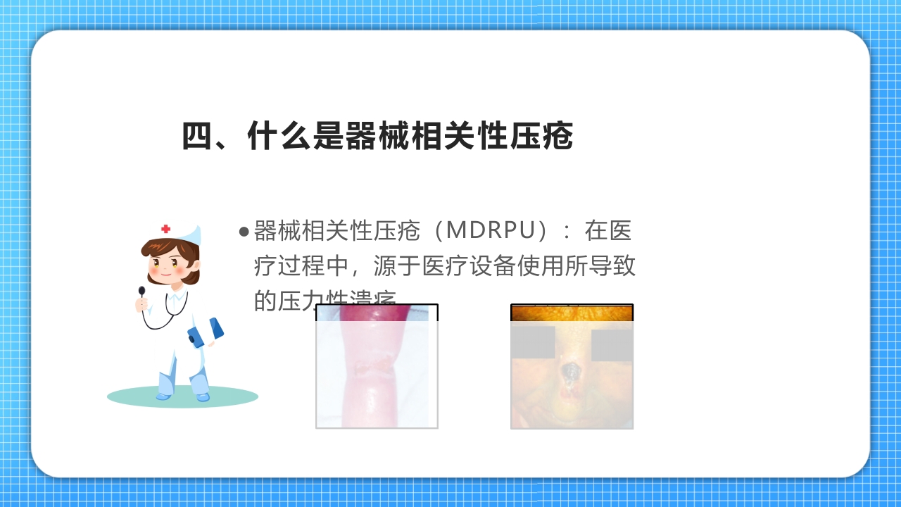医疗压疮护理查房PPT课件8