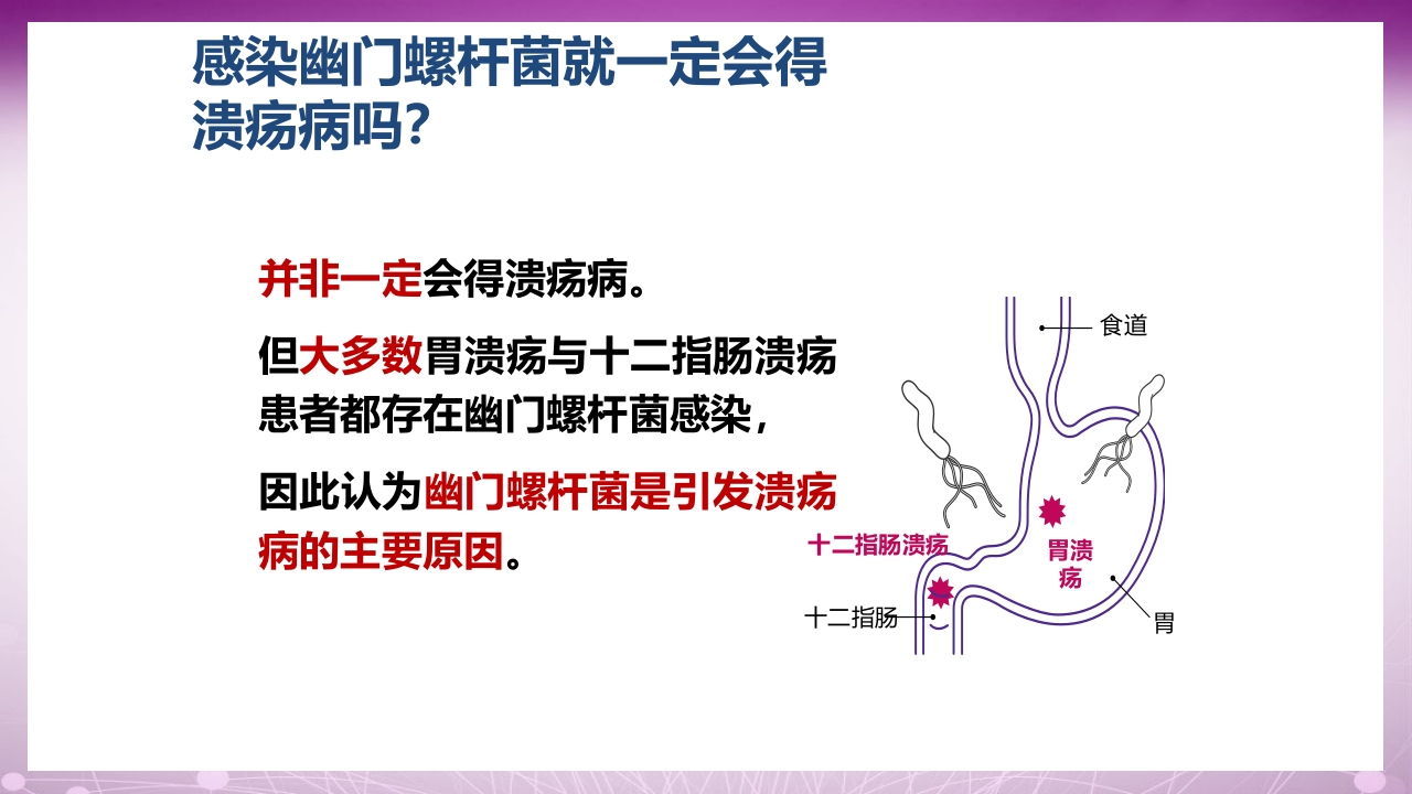幽门螺杆菌感染患者教育PPT课件14