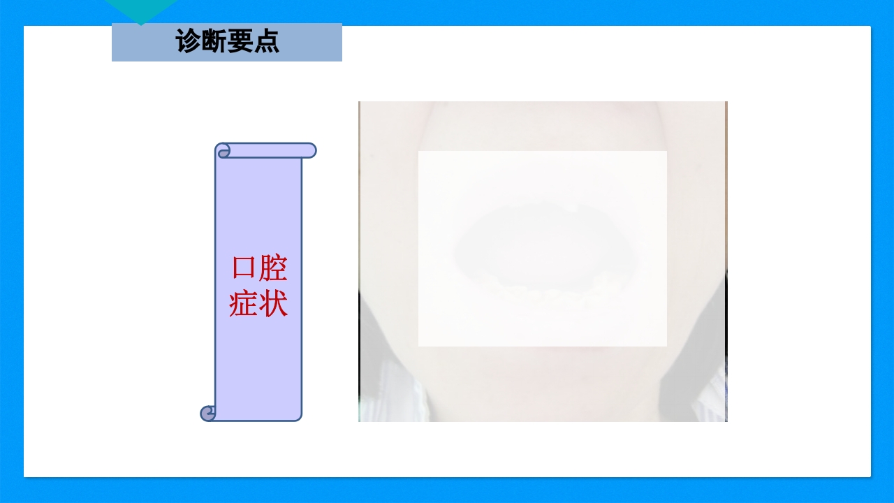 皮肤干燥综合征PPT课件下载13