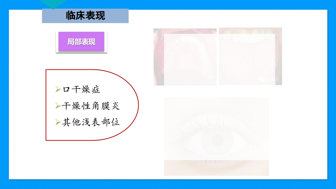 皮肤干燥综合征PPT课件下载6