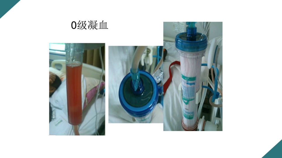 无肝素血液净化治疗的护理PPT课件18