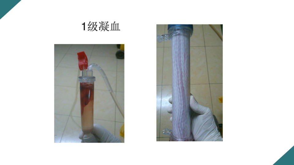 无肝素血液净化治疗的护理PPT课件19