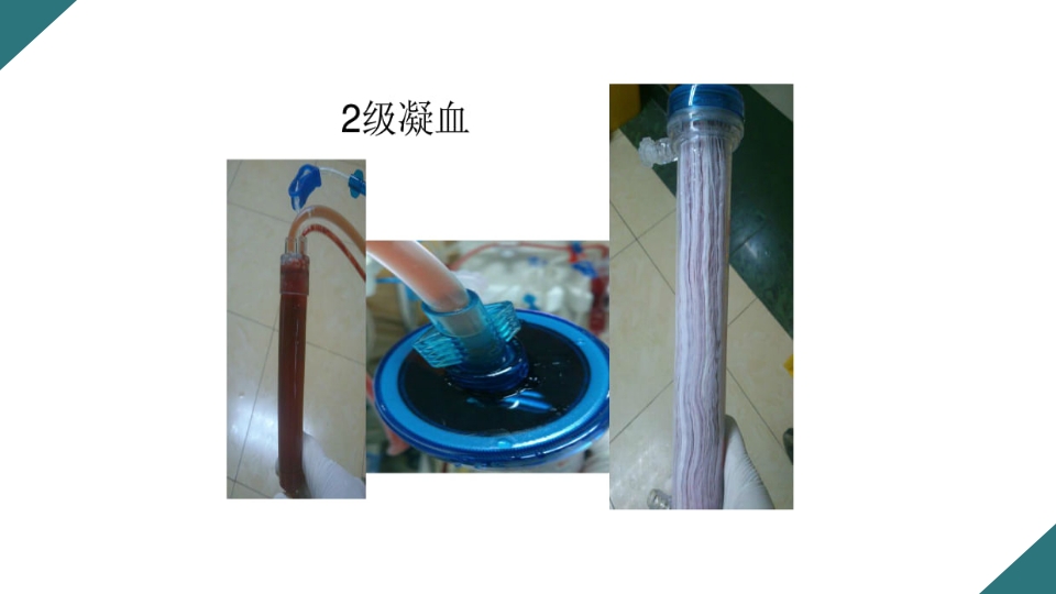 无肝素血液净化治疗的护理PPT课件20