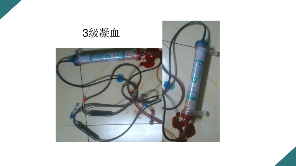 无肝素血液净化治疗的护理PPT课件21