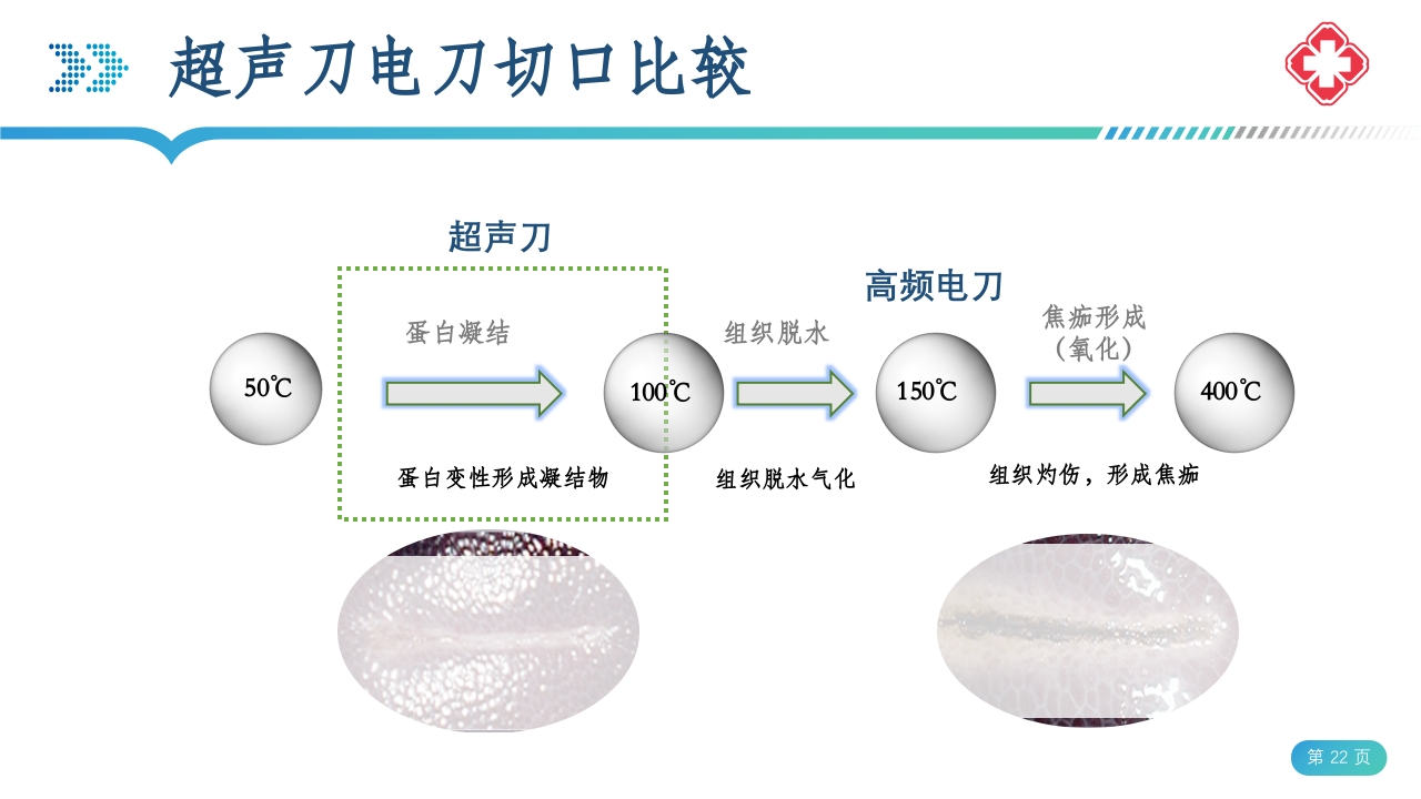 医院手术室电外科安全PPT课件22