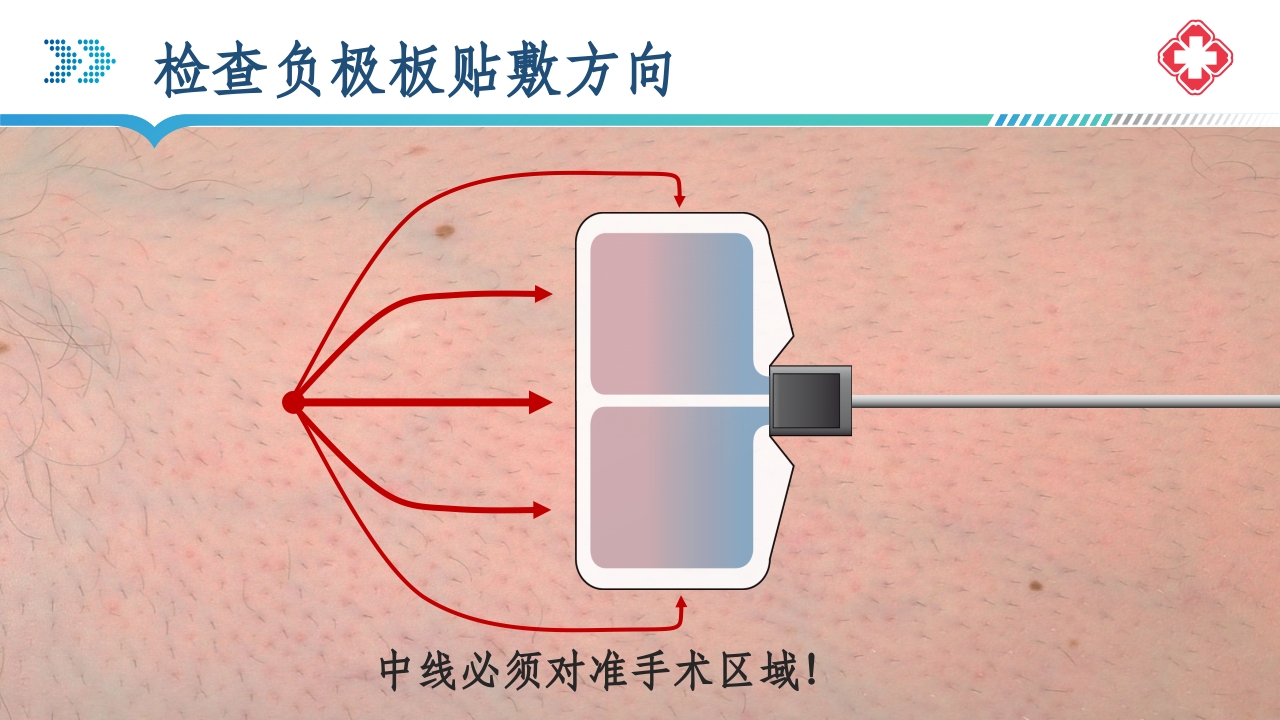 医院手术室电外科安全PPT课件42