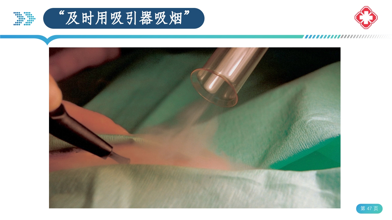 医院手术室电外科安全PPT课件47