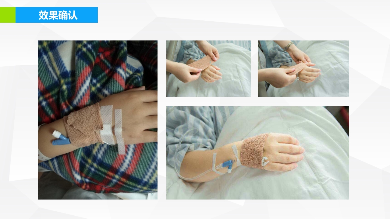 提高孕妇从穿刺到分娩后留置针的完好率·品管圈PPT下载28