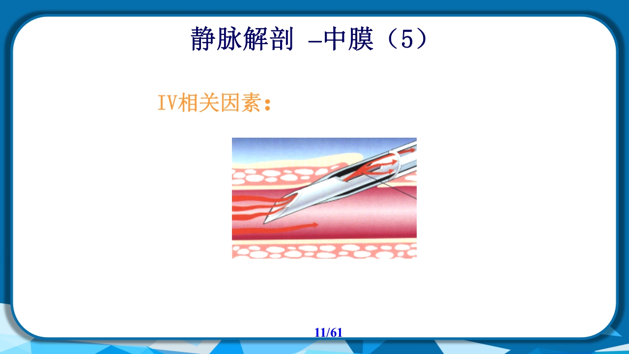 PICC导管相关性血栓形成及处理PPT课件11